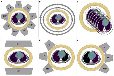 A New Proton Therapy Solution Provides Superior Cardiac Sparing Compared With Photon Therapy in Whole Lung Irradiation for Pediatric Tumor Patients